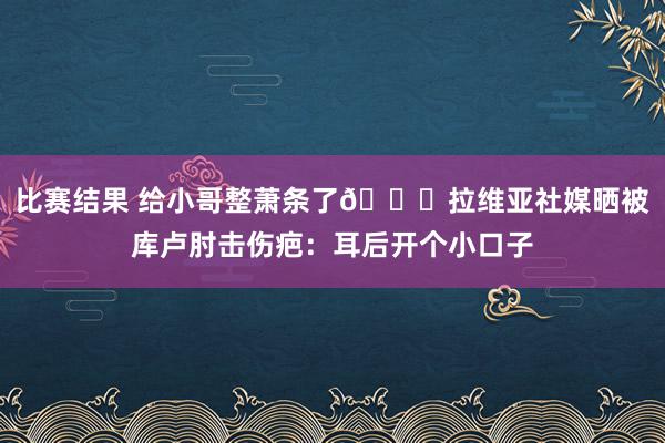 比赛结果 给小哥整萧条了😅拉维亚社媒晒被库卢肘击伤疤：耳后开个小口子